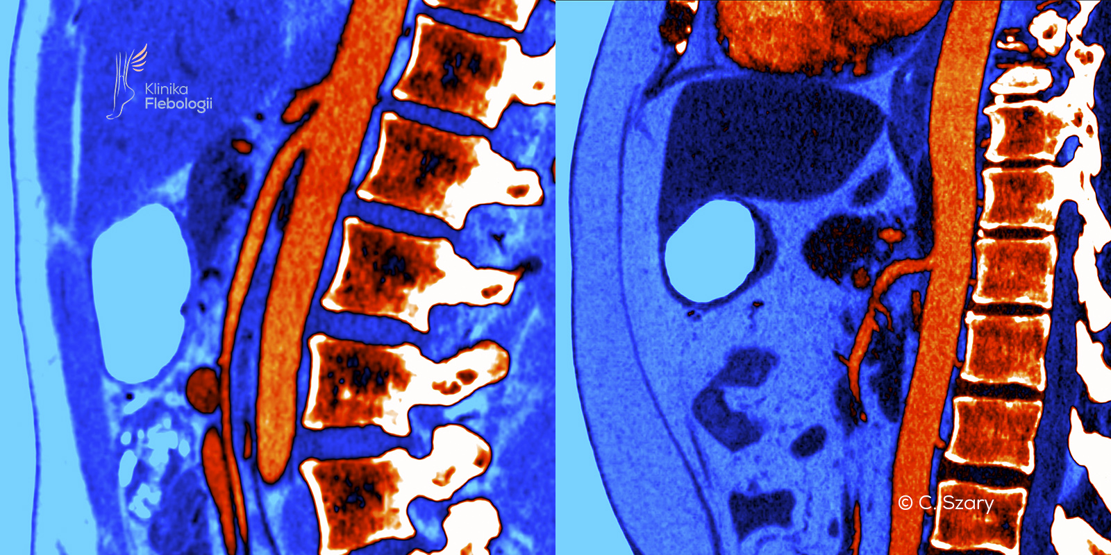 Zespół dziadka do orzechów