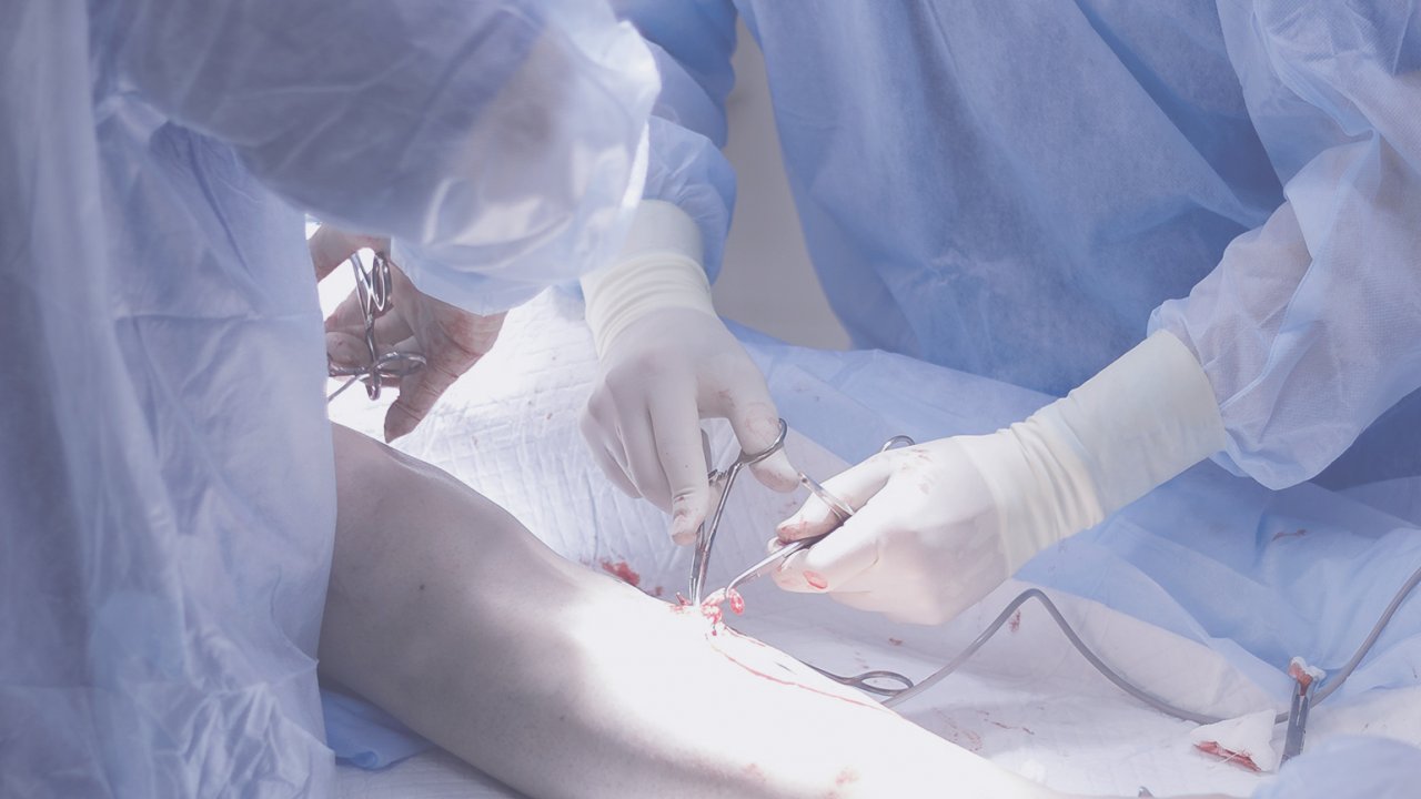 Specjaliści chirurgii naczyniowej