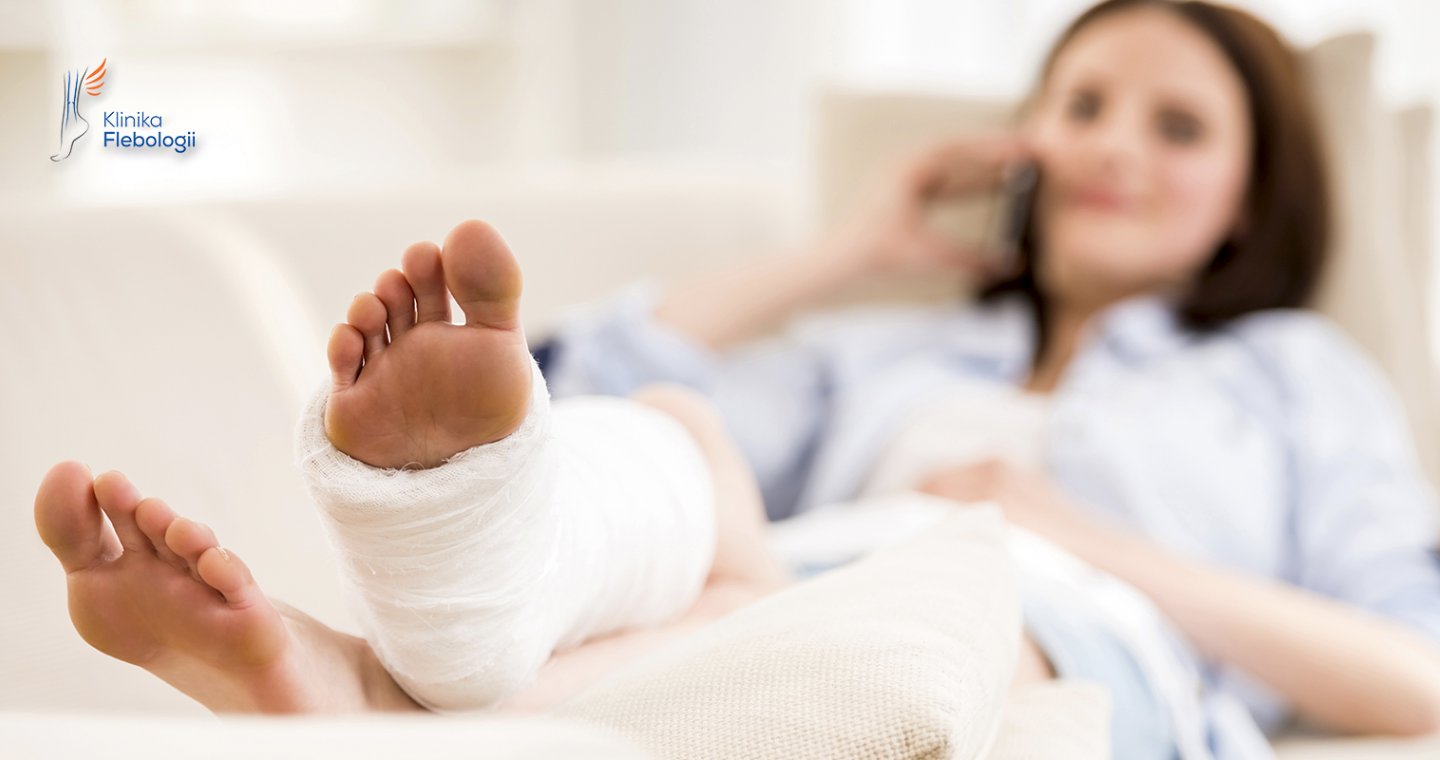 Unieruchomienie kończyny a zakrzepica